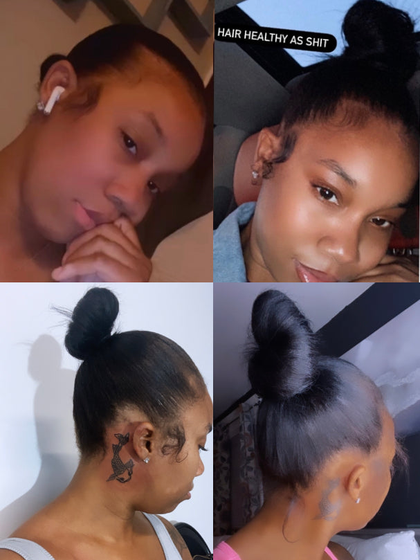 Top left pics hair fell out edges fell could only wear a down bun middle top and back of my hair feel out bottom right is now healthy hair growth with all my edges 